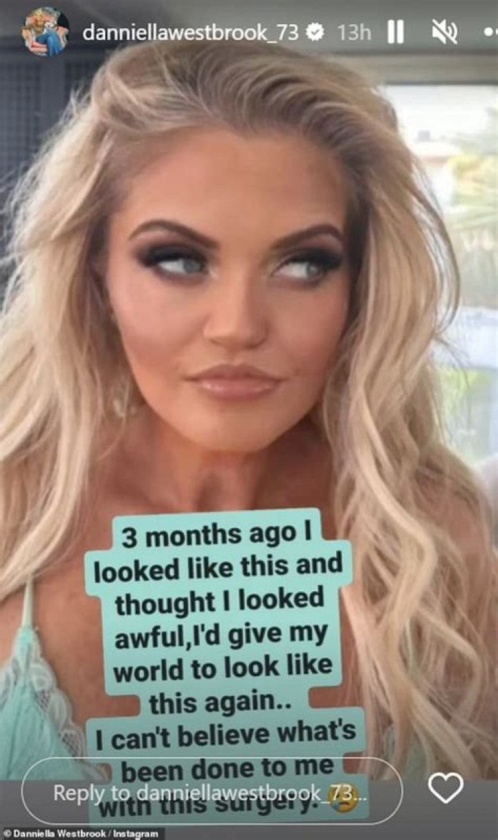 What Happened To Danniella Westbrook Septum? Timeline Of Everything She Has Done On Her Face